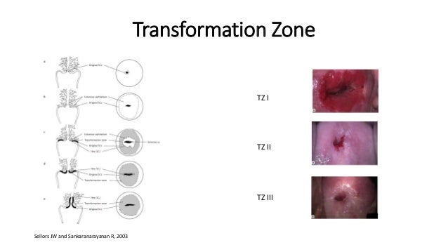 colposcopy diagrams of the vulva Gay ass movies
